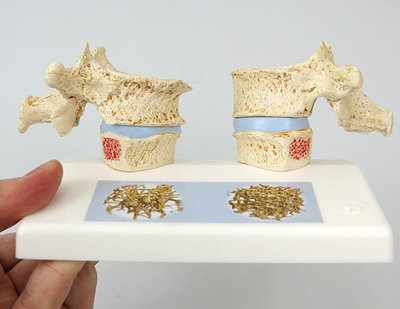 正面