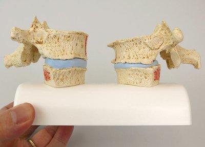 背面