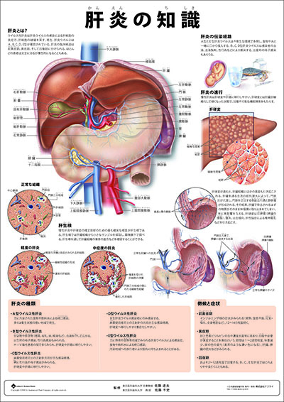 人体解剖図（人体図）　ミニポスター　肝炎の知識