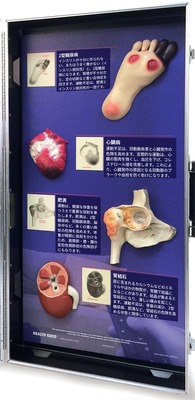 3D模型ディスプレイ 運動不足の危険性の右側のパネル。立体模型4個と日本語の解説