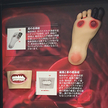 3Dディスプレイ　糖尿病が引き起こすもの　詳細画像