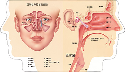 型抜き絵本 鼻腔と副鼻腔疾患 01-02ページ