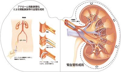型抜き絵本 腎臓 09-10ページ
