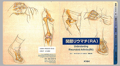 型抜き絵本 関節リウマチ（RA） 表紙