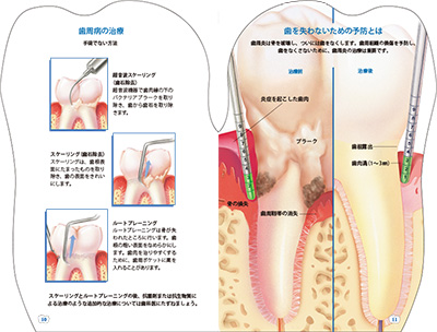 型抜き絵本 歯 09-10ページ