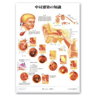 （医学ポスター）　医学掛図　中耳感染の知識