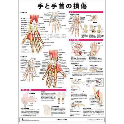 （医学ポスター）　ミニポスター　手と手首の損傷
