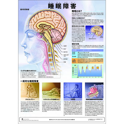 （医学ポスター）　ミニポスター　睡眠障害