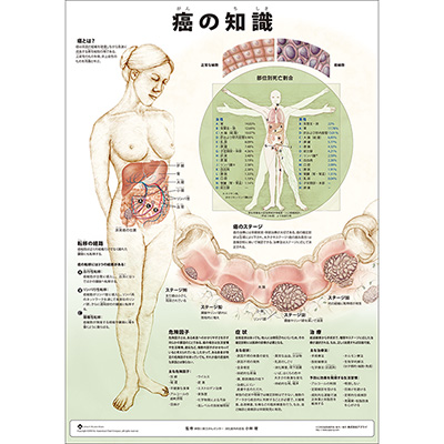 （医学ポスター）　ミニポスター　癌の知識