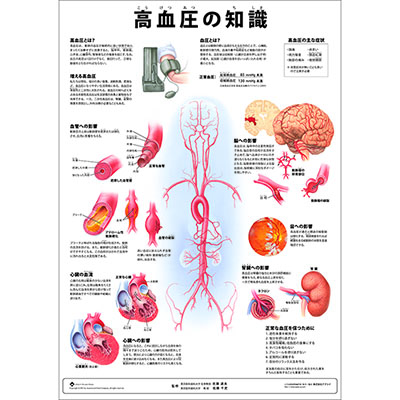 （医学ポスター）　ミニポスター　高血圧の知識