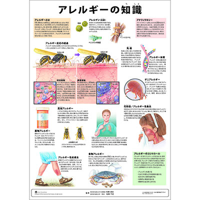 （医学ポスター）　ミニポスター　アレルギーの知識