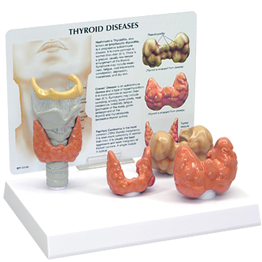 医学模型　甲状腺疾患　GPI Anatomicals