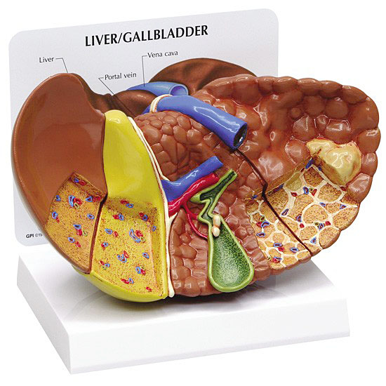 人体模型　肝臓と諸疾患　GPI Anatomicals