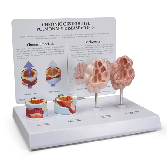 人体模型　COPD　GPI Anatomicals