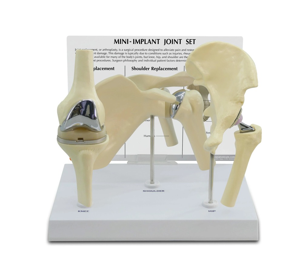 医学模型 ミニ人工関節セット/膝・肩・股関節 GPI Anatomicals