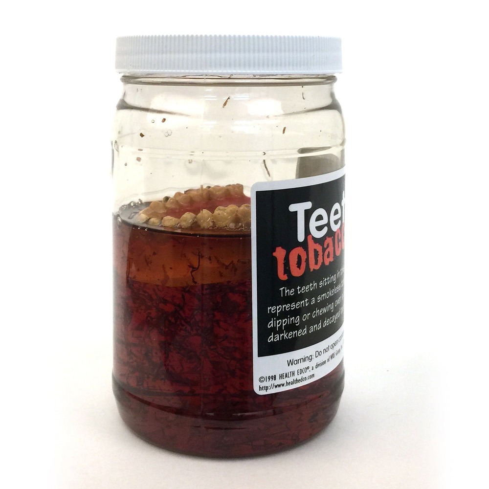 禁煙教育用ディスプレイ タバコ液に浸かった歯(英語版のみ)
